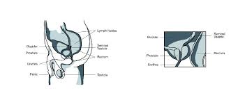 Prostate cancer metastasis occurs when cells break away from the tumor in the prostate. Healthcare For Men Prostate Cancer Caring For Your Health