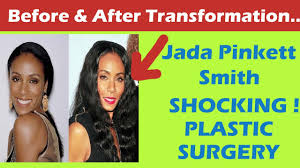 28.09.2021 · jada pinkett smith and her daughter willow smith both considered bum surgery. Jada Pinkett Smith Plastic Surgery Before And After Full Hd Youtube