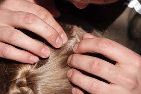 Getting rid of the itch begins with finding out why your scalp itches. What Is Scalp Acne How To Treat Pimples On Your Scalp Allure