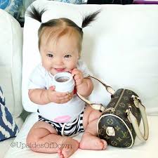 These Photos Of Babies With Down Syndrome Prove That They Grow Up Like Everyone Else Bebe Con Sindrome De Down Nino Swag Ninos