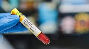 Test Sierologici Privati Anche Nei Laboratori Casa Salute Un Esame Con 60 Euro Genova 24