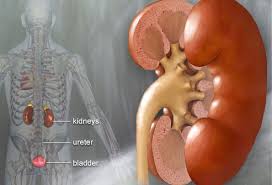 Kidney Stone Pictures Symptoms Causes Treatments And