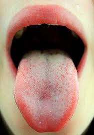 Maybe you would like to learn more about one of these? Bad Breath Wikipedia