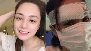 More Details About Gillian Chung's Hotel Room Accident, Which Left Her With  A 6cm Wound On Her Head