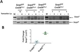 No recombination could be observed in the progenies in the absence of. Uncovering The Fine Print Of The Creert2 Loxp System While Generating A Conditional Knockout Mouse Model Of Ssrp1 Gene