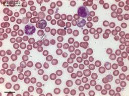 Falciparum is the most severe strain of the malaria species correlated with almost every malarial death.1 the other 3 species that cause malaria include: Plasmodium Sp Protozoa Monster Hunter S Guide To Veterinary Parasitology