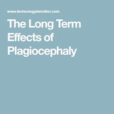 Long Term Effects Of Plagiocephaly Plagiocephaly In Adults Term Long Torticollis