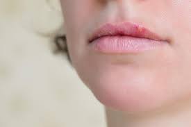 Maybe you would like to learn more about one of these? Bump On Lip Causes Treatment And When To See A Doctor