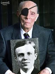 Husband injured during military training in Germany