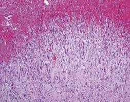 We did not find results for: Desmoplastic Malignant Mesothelioma Thoracic Pathology A Volume In The High Yield Pathology Series Expert Consult Online And Print 1st Edition