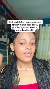 Best Body Lotion for Skin Lightening & Clearing Stretch Marks