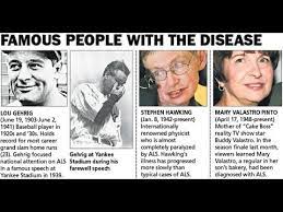 Understanding Amyotrophic Lateral Sclerosis Als Disease Youtube
