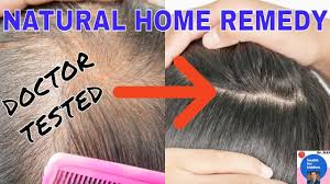 Ensure your hair care routine is in place with these simple tips. Hair Loss In Teenagers Increase Hair Volume Naturally Home Remedy 5 Increase Hair Volume Volume Hair Hair Loss