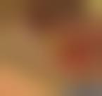 Image result for Alveolitis sicca)