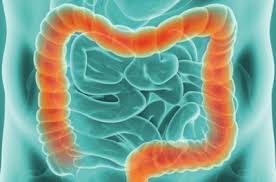 Bleeding from your bottom or blood in your bowel movements, even if only occasional a change in bowel habits for longer than two weeks, such as: Our Clinical Trials Colorectal Cancer Gi Cancer