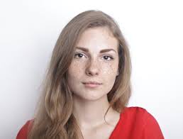 Image result for Freckled skin