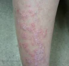 Pin On All Health