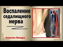 как лечить воспаление яичников у женщин в домашних условиях Recept Ingredienty 5 Zubchikov Chesnoka 200 Ml Moloka Med Po Zhelaniyu Podgotovka I Ispolzovanie Ochistite Sedalishnyj Nerv Myshechnaya Sistema Zdorove I Krasota