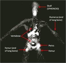 Check spelling or type a new query. Ghoulology 101 Kakuhous Rc Pathways And Rc Cells