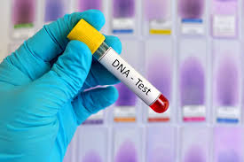 DNA Testing – Dr. Jones MD