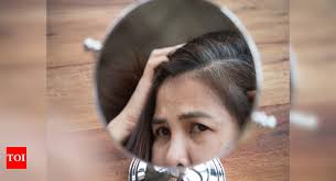 Your hair shouldn't be dyed in black. Homeopathy Medicines For Gray Hair Homeopathy To Prevent Premature Graying Of Hair