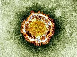 Il colera, la peste o l'influenza spagnola sono invece malattie prevalentemente epidemiche. Entenda A Diferenca Entre Epidemia Pandemia Endemia E Surto Revista Galileu Saude