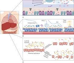 Maybe you would like to learn more about one of these? Pathophysiology Of Neonatal Sepsis Abstract Europe Pmc