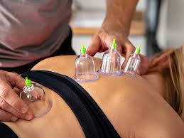 Dry Cupping