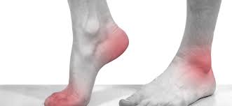 Podiatry And Cbd 7 Ways Cbd Oil May Help With Foot Problems