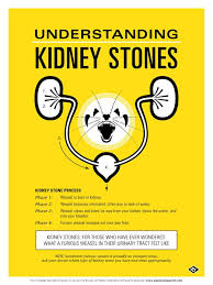Dec 12, 2018 · during a serious kidney stone attack at age 37, i went into a coma and saw a light at the end of a tunnel. Kidney Stones Jokes