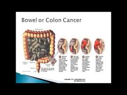 Pin On Health