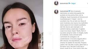 At 16 she obtained the. Youtg Net Kasia Smutniak Lancia Il Filtro Instagram Con La Vitiligine La Bellezza Della Diversita
