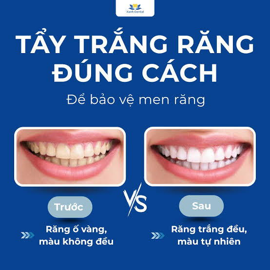 Dịch vụ chuyên sâu tại Nha Khoa Xanh Dental CS2 - Phố Nhổn