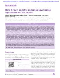 Pdf Hand X Ray In Pediatric Endocrinology Skeletal Age