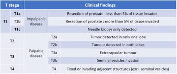 Image result for Prostate Cancer Staging