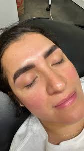 Peach Fuzz Hair Removal Company LLC