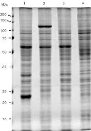 A good exterminator should liaise with you and your family about the costs, procedures, and preventions as because pest control companies use poisons, pesticides, and chemical fumigants, they are required. Sds Page Analysis Of Proteins Produced By Bacpakv Trex Virus Soluble Download Scientific Diagram