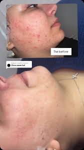 By Mariam Abed Ali 💊