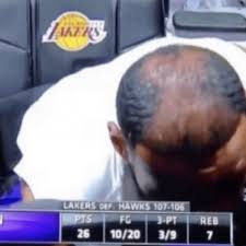 Последние твиты от lebron's hairline (@thehairline6). Lebron Roasts His Own Hairline In Savage Tweet Fadeaway World