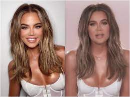 Doctor reacts to khloe kardashian's plastic surgery! Khloe Kardashian S Face Alterations Plastic Surgeons Explain
