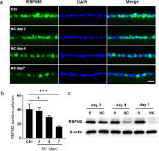 Être établie dans le cadre plus large des seules. Metabolomic Changes In The Mouse Retina After Optic Nerve Injury Scientific Reports