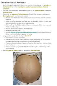 Image result for Shifting Dullness Test