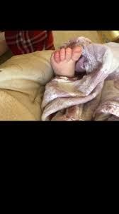No matter how stylish your sandals or flip flops are, wearing them accounts to nothing if you have toes that are hairy. Hair Wrapped Around Baby Toes September 2018 Babies Forums What To Expect