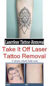 Can Tattoos Be Removed Completely Tattoo Removal La How Much It Cost To Remove A Small Tattoo Removable Tattoo Ink Can Tattooentfernung Tattoos Tatowierungen