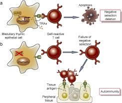 Image result for Autoimmunity