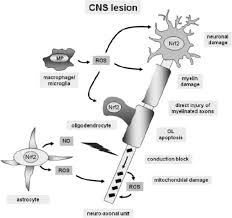 Cns demyelinating diseases discussed in this article include multiple sclerosis, acute disseminated encephalomyelitis, devic's disease, and acute necrotizing hemorrhagic encephalomyelitis. Mitochondrial Dysfunction In Demyelinating Diseases Sciencedirect