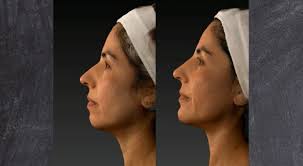 Violencia luego de un partido de futsal: habló el presidente del club  agresor