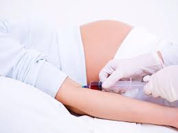 Novel Cell Free Dna Blood Test Effectively Detects Down Syndrome