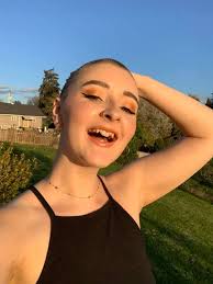 I have short thick blonde hair that is my pride and joy but I have came to  realize that I am having a bad dandruff issue. My hair has to be washed