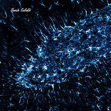 Astrocytes In The Hippocampus Central Nervous System Star Shape Image Shows